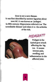 Gout - What You Need To Know